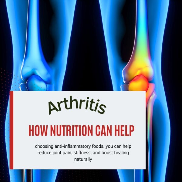 Arthritis: How Nutrition Can Help